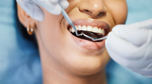 Best Emergency Denture Repair in Blossburg, PA
